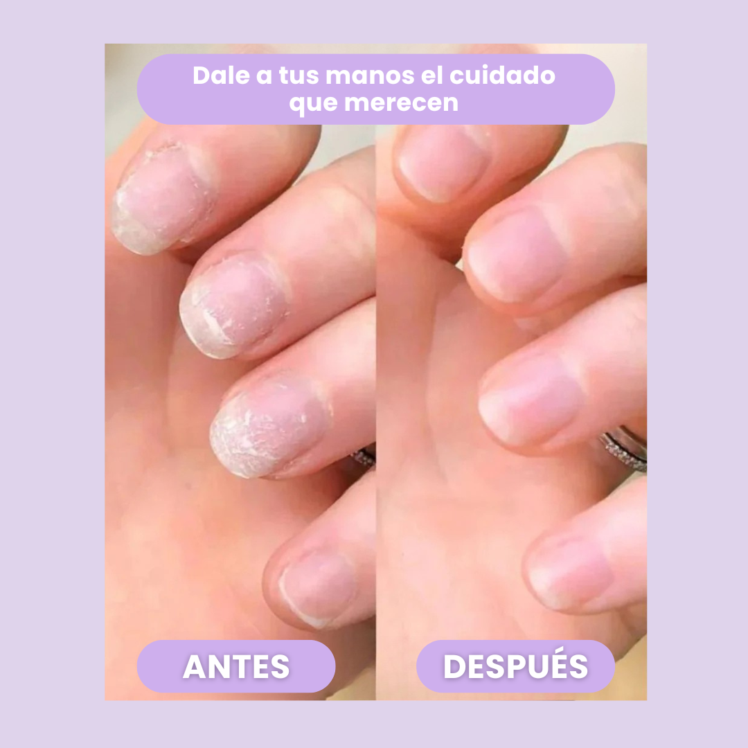 NeoVess Nail - Fortalece y Acelera el Crecimiento de tus Uñas