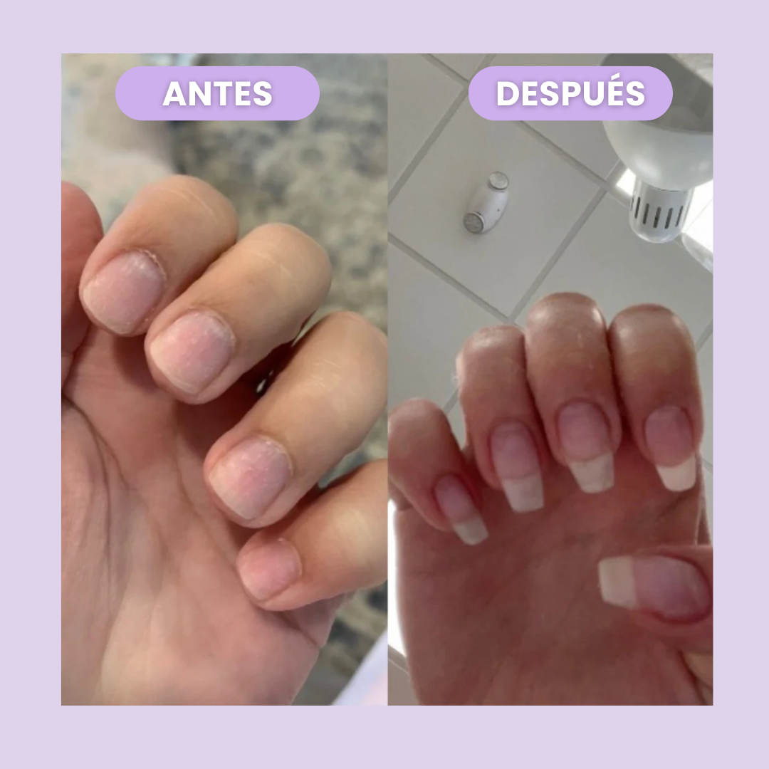 NeoVess Nail - Fortalece y Acelera el Crecimiento de tus Uñas