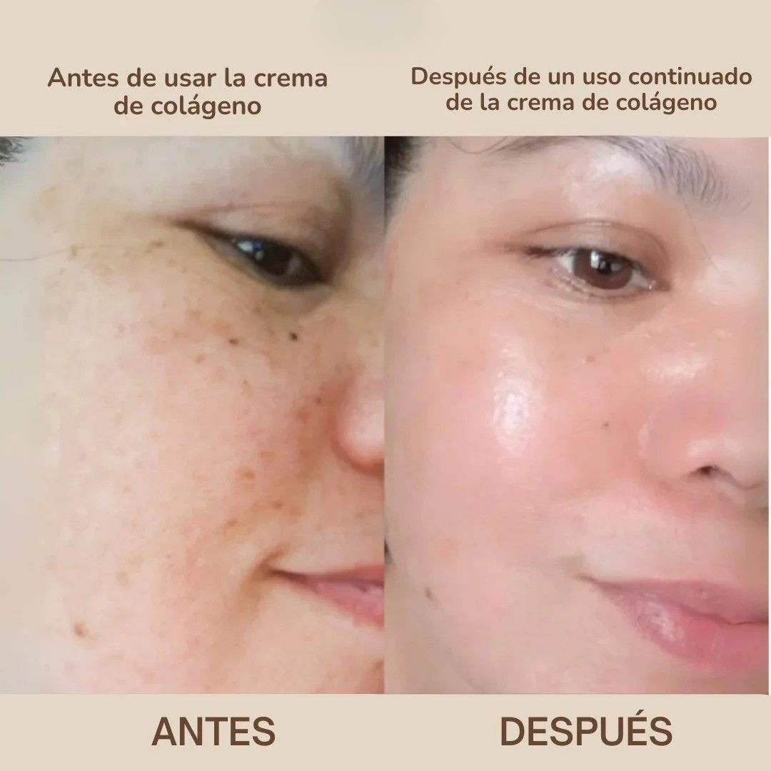 Crema de Colágeno con Niacinamida