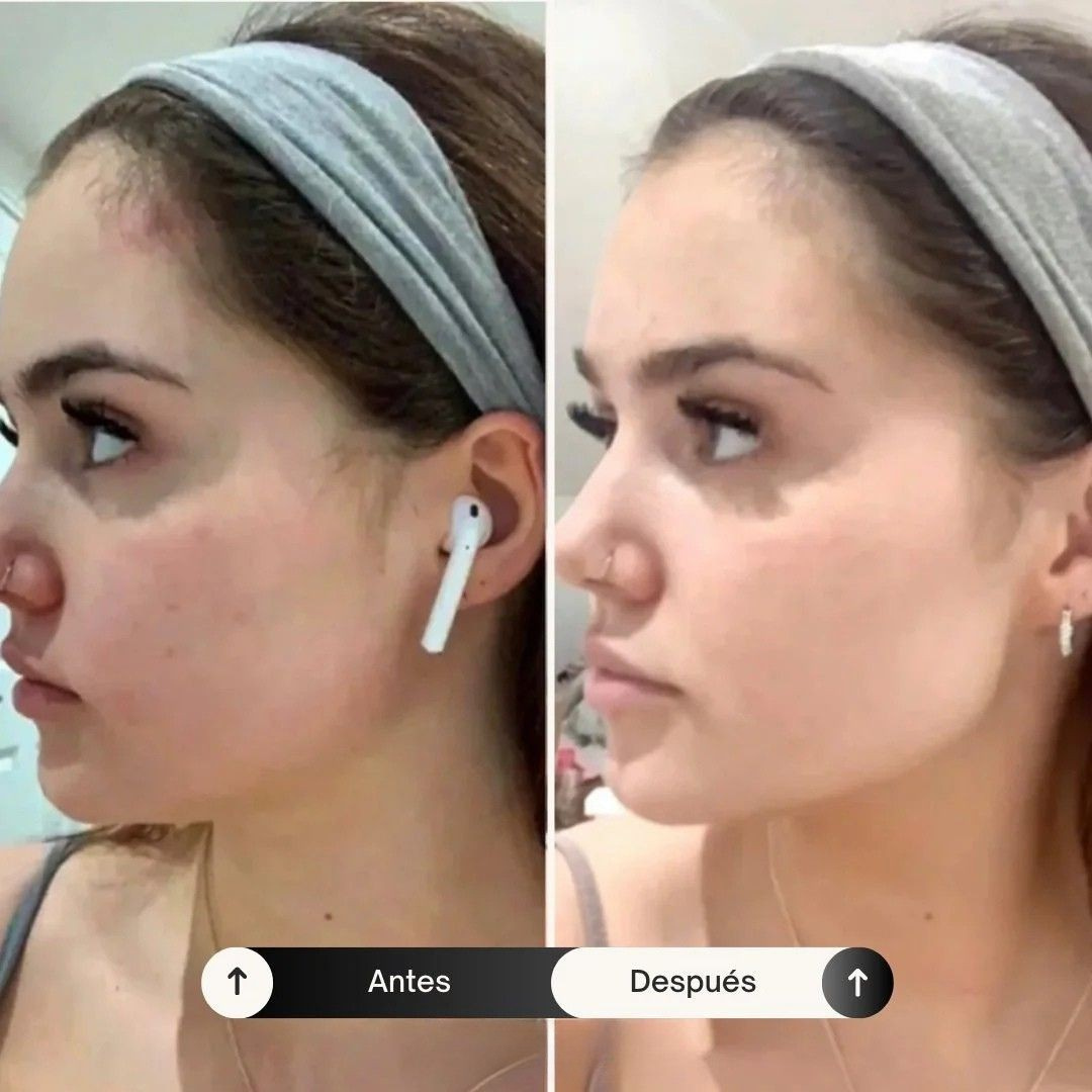 EssenceLift™ - Rejuvenece y Reafirma tu Piel