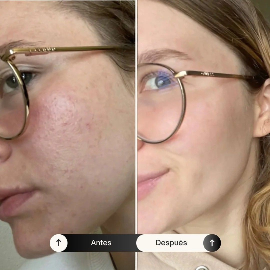 EssenceLift™ - Rejuvenece y Reafirma tu Piel