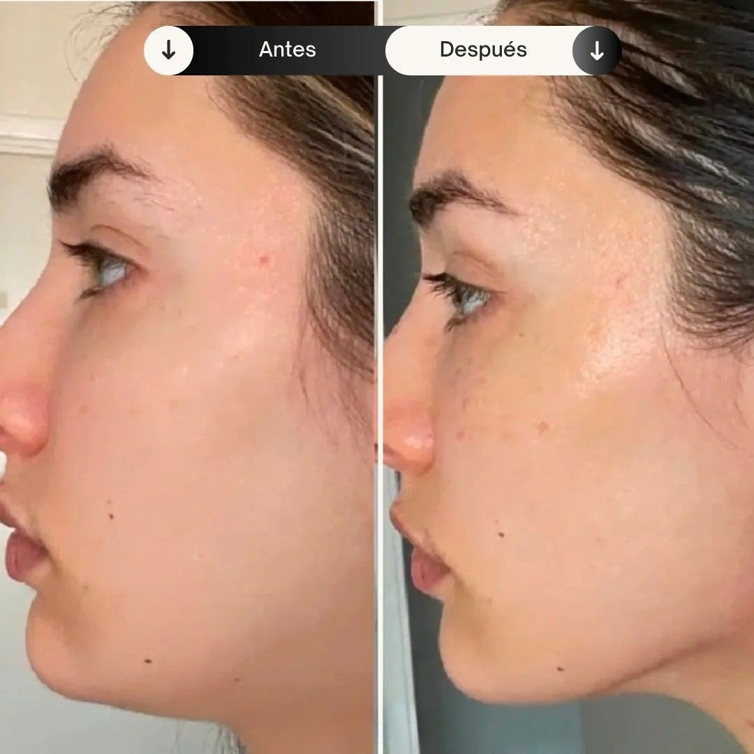 EssenceLift™ - Rejuvenece y Reafirma tu Piel