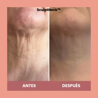 SculptNeck™ – Crema reafirmante para cuello y mentón