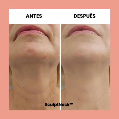 SculptNeck™ – Crema reafirmante para cuello y mentón
