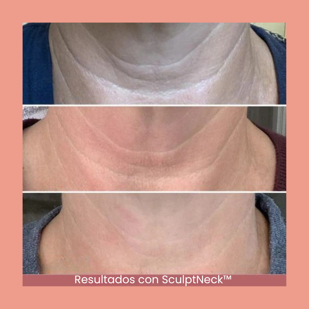 SculptNeck™ – Crema reafirmante para cuello y mentón