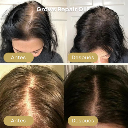 Grows Repair Oil™ – Suero Capilar para Frenar la Caída y Estimular el Crecimiento