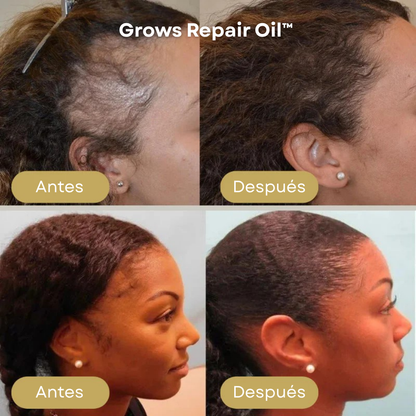 Grows Repair Oil™ – Suero Capilar para Frenar la Caída y Estimular el Crecimiento