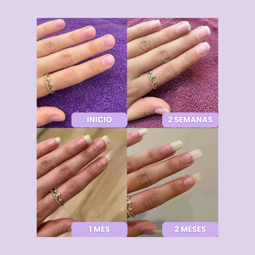 NeoVess Nail - Fortalece y Acelera el Crecimiento de tus Uñas