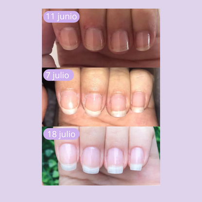 NeoVess Nail - Fortalece y Acelera el Crecimiento de tus Uñas
