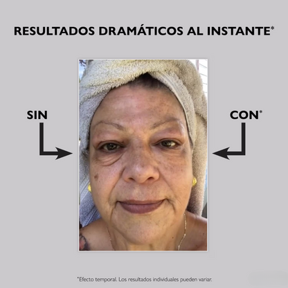 Instant FIRMx Eye™ - Lifting de ojos al instante