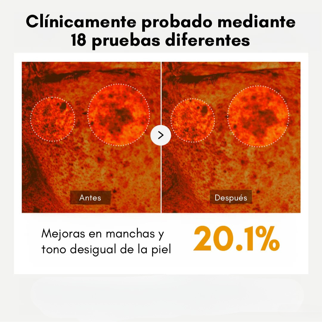 GlowPearls™ – Cápsulas de Vitamina C para iluminar y reafirmar la piel