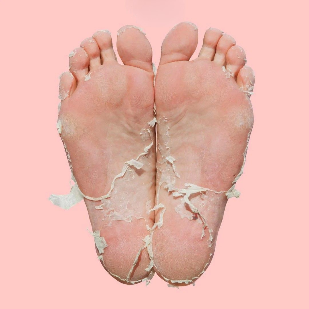 Mascarilla Exfoliante para Pies -  ¡Pies perfectos este verano!