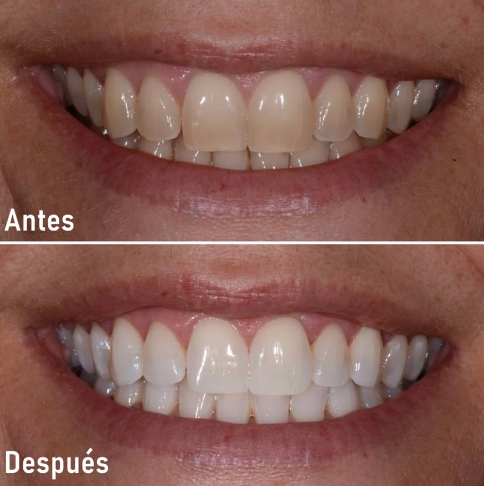 <strong>— Karla R., Monterrey</strong>
